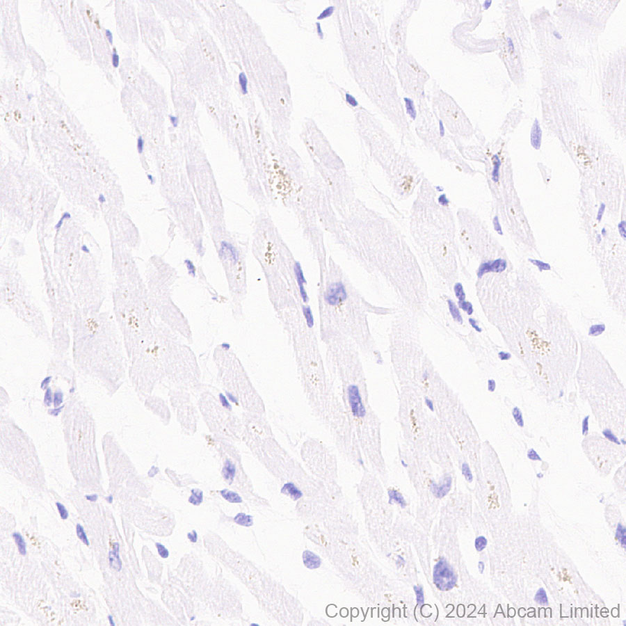 Immunohistochemistry (Formalin/PFA-fixed paraffin-embedded sections) - Anti-TrkB antibody [RM1253] (ab322464), expandable thumbnail