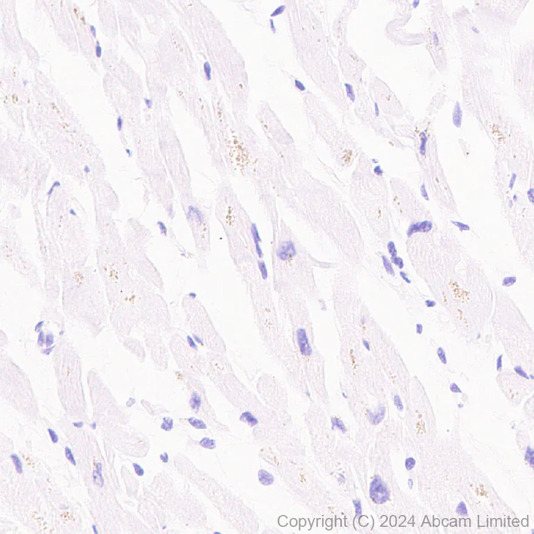 Immunohistochemistry (Formalin/PFA-fixed paraffin-embedded sections) - Anti-TrkB antibody [RM1253] (AB322464)