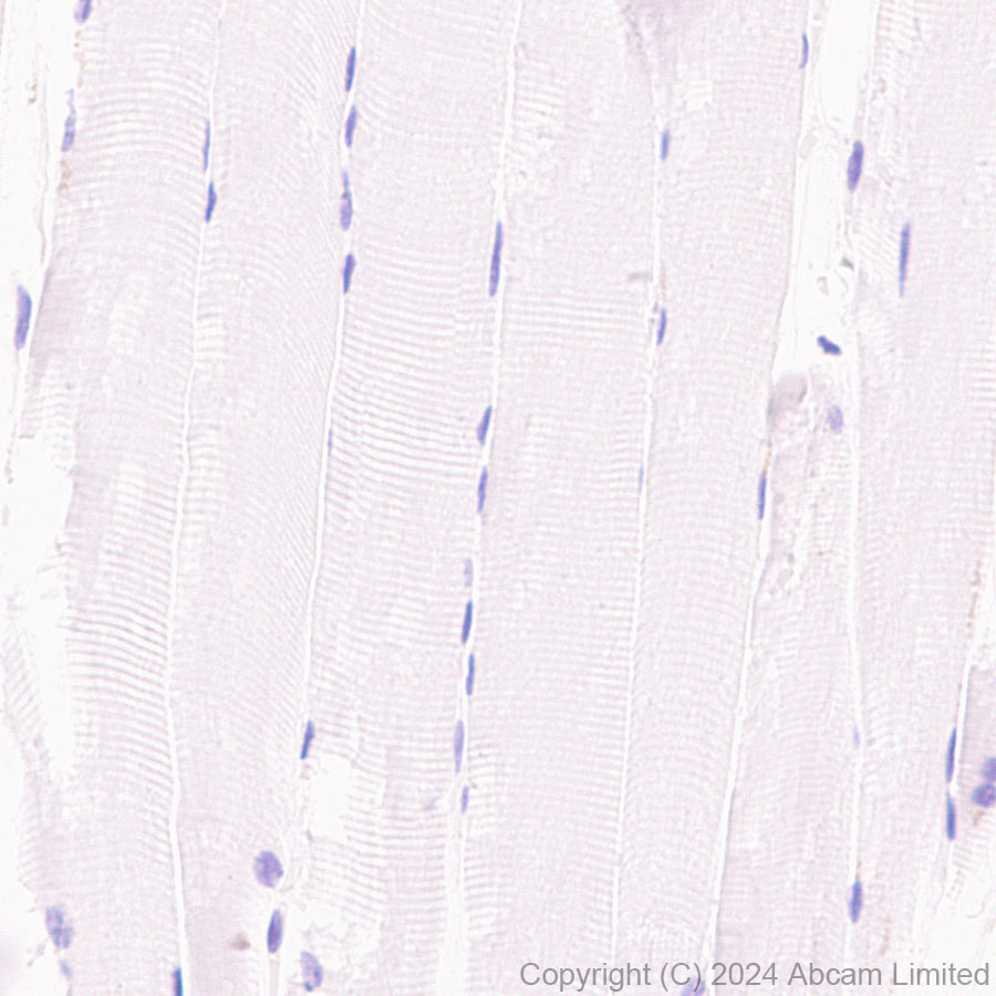 Immunohistochemistry (Formalin/PFA-fixed paraffin-embedded sections) - Anti-TrkB antibody [RM1253] (ab322464), expandable thumbnail