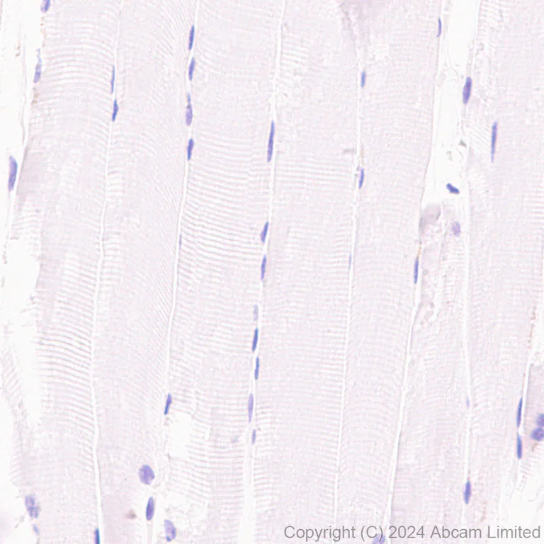 Immunohistochemistry (Formalin/PFA-fixed paraffin-embedded sections) - Anti-TrkB antibody [RM1253] (AB322464)