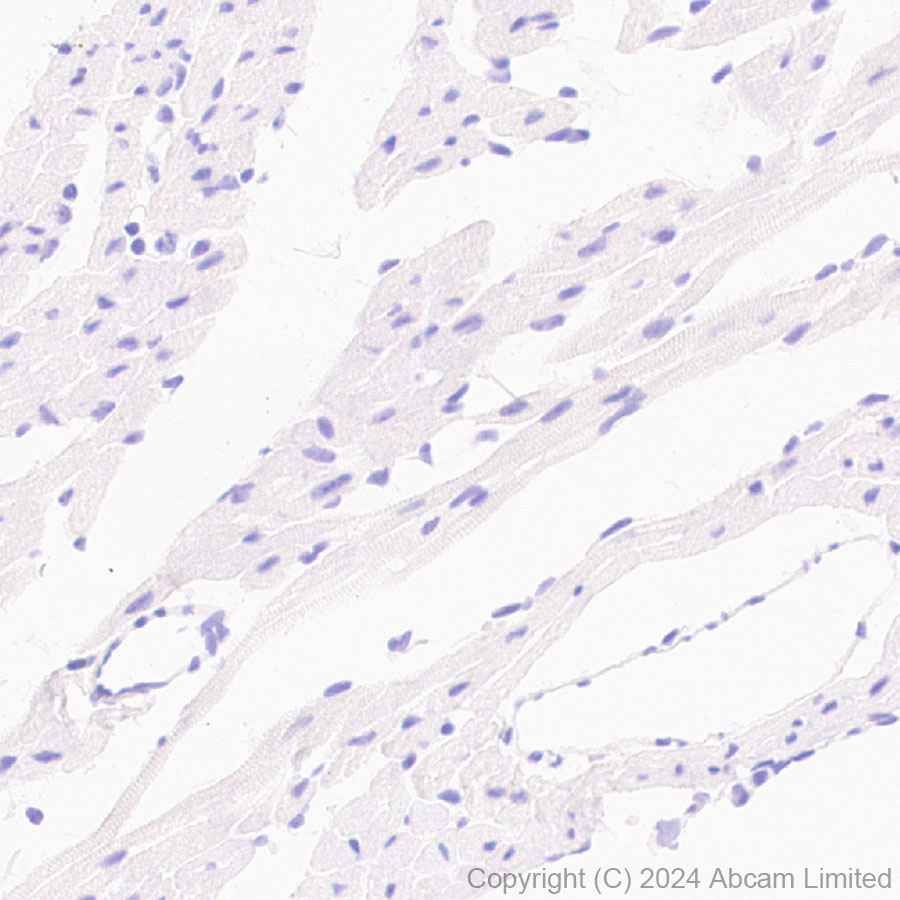 Immunohistochemistry (Formalin/PFA-fixed paraffin-embedded sections) - Anti-TrkB antibody [RM1253] (ab322464), expandable thumbnail