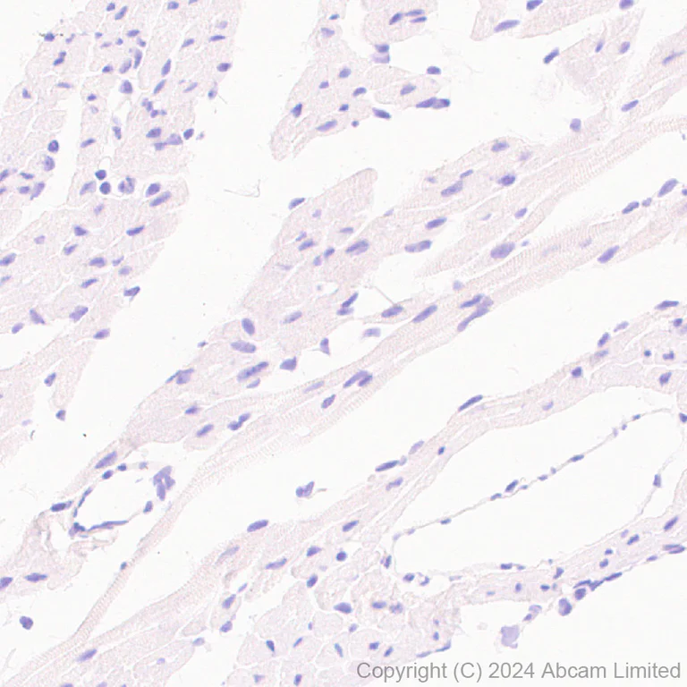 Immunohistochemistry (Formalin/PFA-fixed paraffin-embedded sections) - Anti-TrkB antibody [RM1253] (AB322464)