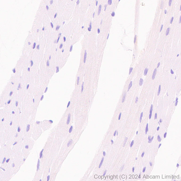 Immunohistochemistry (Formalin/PFA-fixed paraffin-embedded sections) - Anti-TrkB antibody [RM1253] (AB322464)