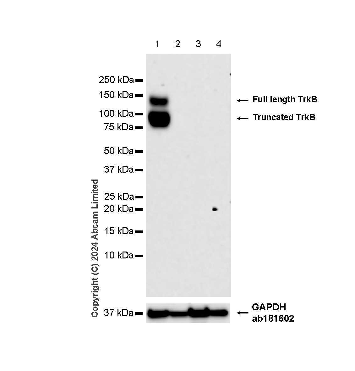 Western blot - Anti-TrkB antibody [RM1253] (AB322464), expandable thumbnail