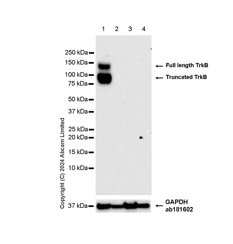 Western blot - Anti-TrkB antibody [RM1253] (AB322464)