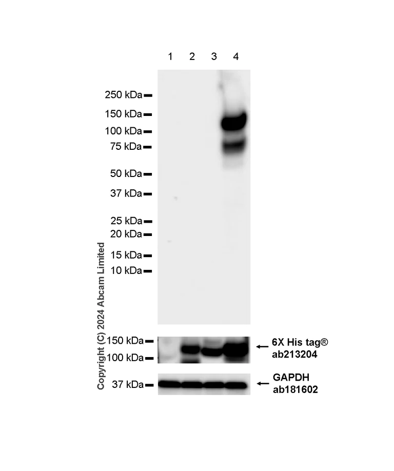 Western blot - Anti-TrkB antibody [RM1253] (AB322464)