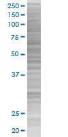 SDS-PAGE - TrkB overexpression 293T lysate (whole cell) (AB94193), expandable thumbnail
