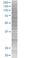 SDS-PAGE - TrkB overexpression 293T lysate (whole cell) (AB94193)