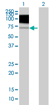 Western blot - TrkB overexpression 293T lysate (whole cell) (AB94193), expandable thumbnail