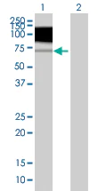 Western blot - TrkB overexpression 293T lysate (whole cell) (AB94193)
