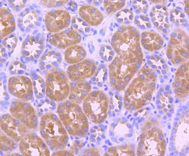 Immunohistochemistry (Formalin/PFA-fixed paraffin-embedded sections) - Anti-TrkB (phospho Y817) antibody [SC0556] (AB326623)