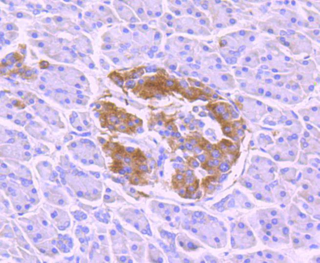 Immunohistochemistry (Formalin/PFA-fixed paraffin-embedded sections) - Anti-TrkB (phospho Y817) antibody [SC0556] (AB326623)