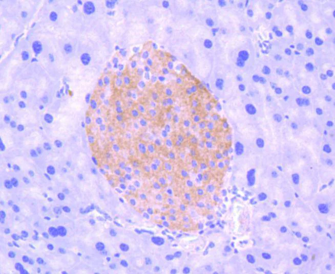 Immunohistochemistry (Formalin/PFA-fixed paraffin-embedded sections) - Anti-TrkB (phospho Y817) antibody [SC0556] (AB326623)