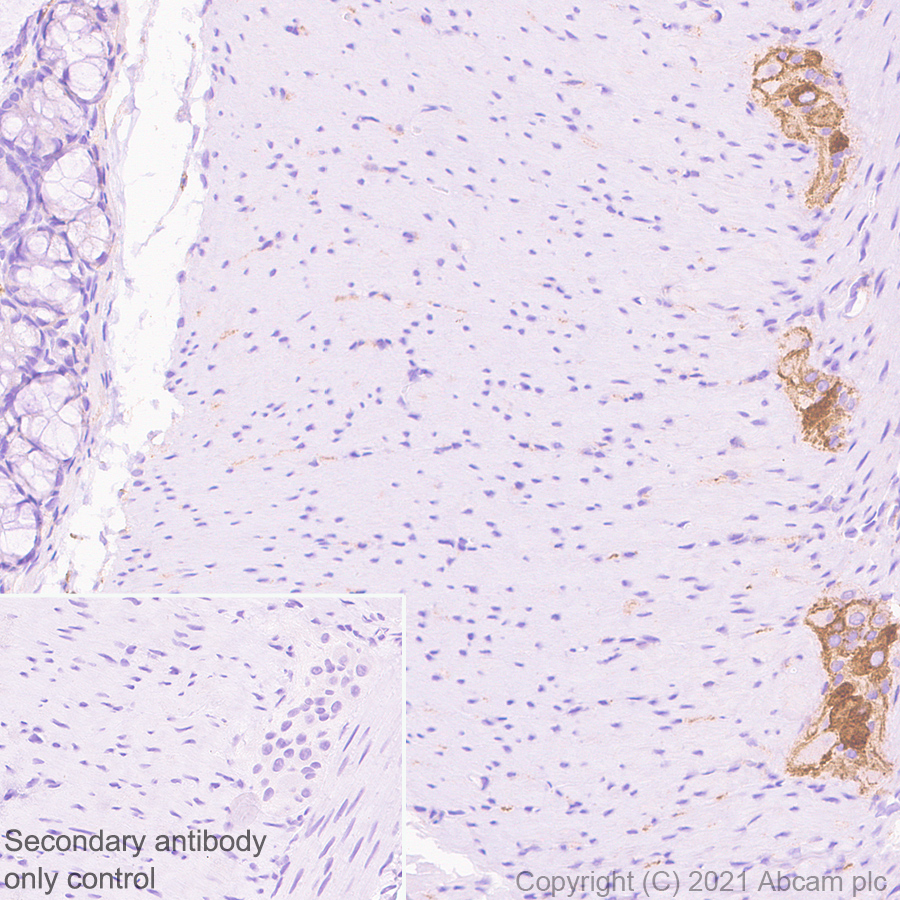 Immunohistochemistry (Formalin/PFA-fixed paraffin-embedded sections) - Anti-TrkC antibody [EPR22959-40] (AB240651)