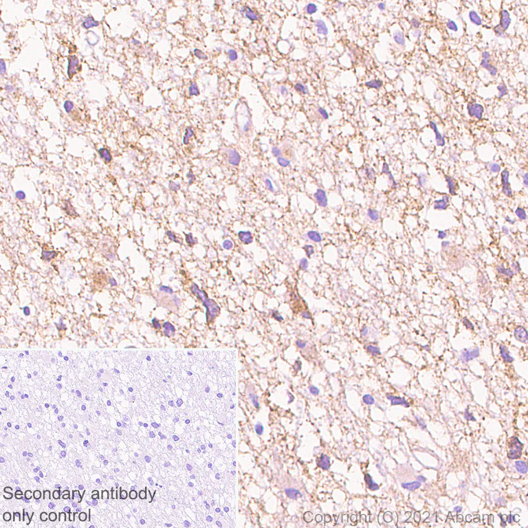 Immunohistochemistry (Formalin/PFA-fixed paraffin-embedded sections) - Anti-TrkC antibody [EPR22959-40] (AB240651)