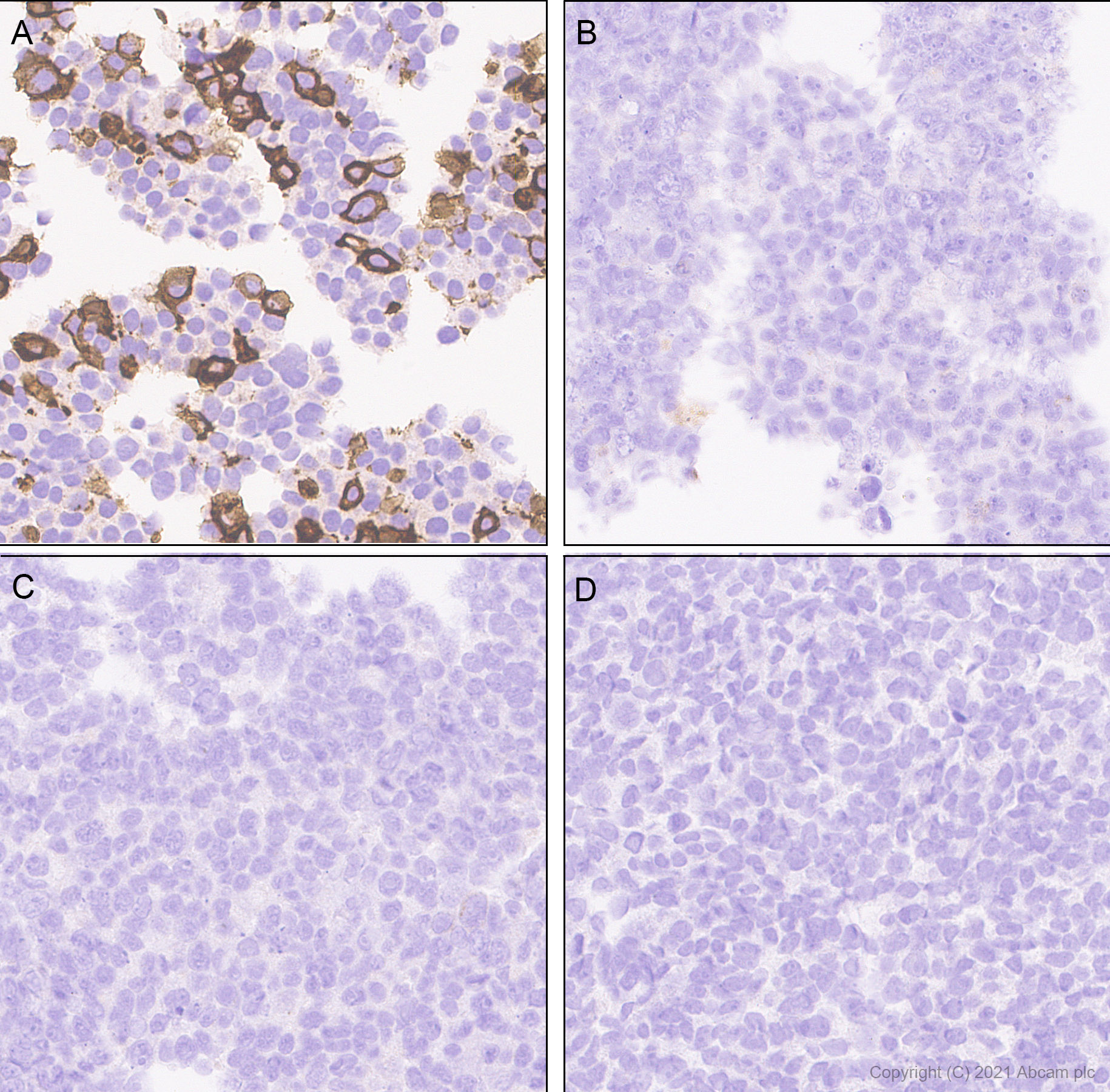 Immunohistochemistry (Formalin/PFA-fixed paraffin-embedded sections) - Anti-TrkC antibody [EPR22959-40] (AB240651)