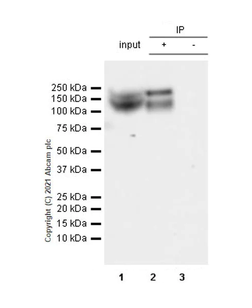 Immunoprecipitation - Anti-TrkC antibody [EPR22959-40] (AB240651)