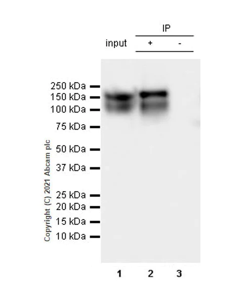 Immunoprecipitation - Anti-TrkC antibody [EPR22959-40] (AB240651)