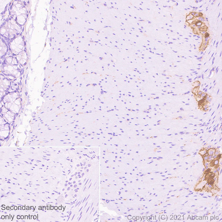 Immunohistochemistry (Formalin/PFA-fixed paraffin-embedded sections) - Anti-TrkC antibody [EPR22959-40] - BSA and Azide free (AB282593)