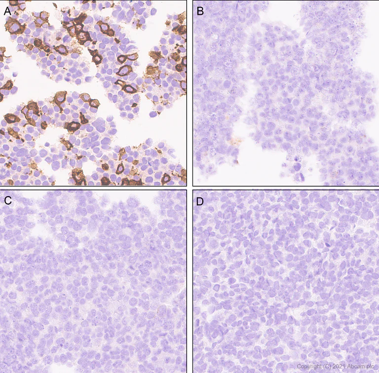Immunohistochemistry (Formalin/PFA-fixed paraffin-embedded sections) - Anti-TrkC antibody [EPR22959-40] - BSA and Azide free (AB282593)