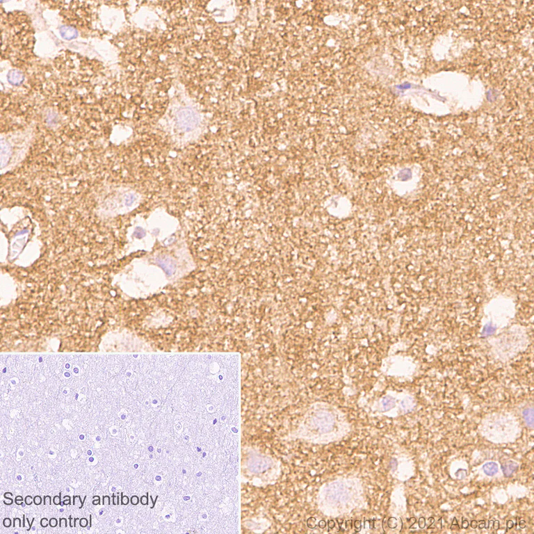 Immunohistochemistry (Formalin/PFA-fixed paraffin-embedded sections) - Anti-TrkC antibody [EPR22959-40] - BSA and Azide free (AB282593)