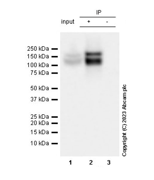 Immunoprecipitation - Anti-TrkC antibody [EPR22959-404] (AB313761), expandable thumbnail
