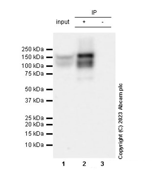 Immunoprecipitation - Anti-TrkC antibody [EPR22959-404] (AB313761), expandable thumbnail