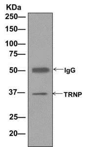 Immunoprecipitation - Anti-TRNP1 antibody [EPR11958] - BSA and Azide free (AB249806)