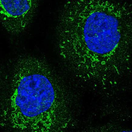 Immunocytochemistry/ Immunofluorescence - Anti-TRNT1 antibody (AB224536)