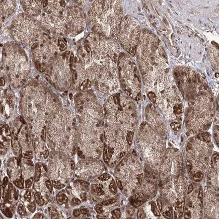 Immunohistochemistry (Formalin/PFA-fixed paraffin-embedded sections) - Anti-TRNT1 antibody (AB224536)