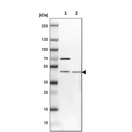 Western blot - Anti-TRNT1 antibody (AB224536)