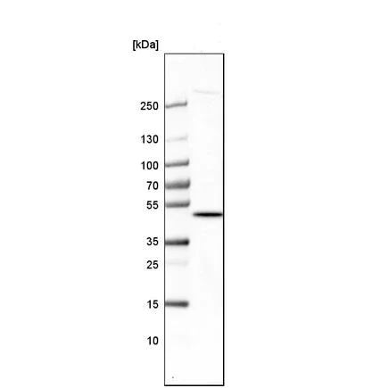 Western blot - Anti-TRNT1 antibody (AB224536)