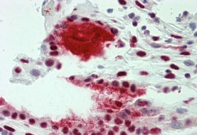 Immunohistochemistry (Formalin/PFA-fixed paraffin-embedded sections) - Anti-TROP2 antibody (AB194956)