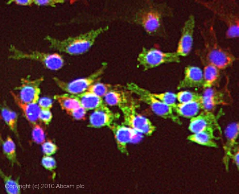 Immunocytochemistry/ Immunofluorescence - Anti-TROP2 antibody (AB64320)