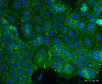 Immunocytochemistry - Anti-TROP2 antibody [EPR20043] (AB214488)
