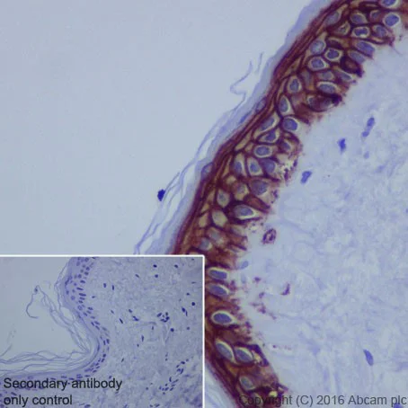 ピークハンド+α カリブ② Anti-TROP2 antibody [EPR20043] KO tested (ab214488) | Abcam