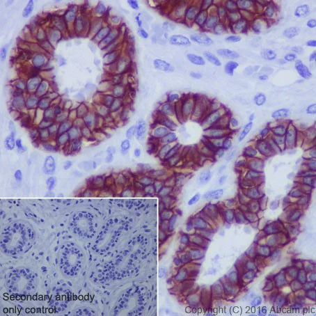 Anti-TROP2 antibody [EPR20043] KO tested (ab214488) | Abcam