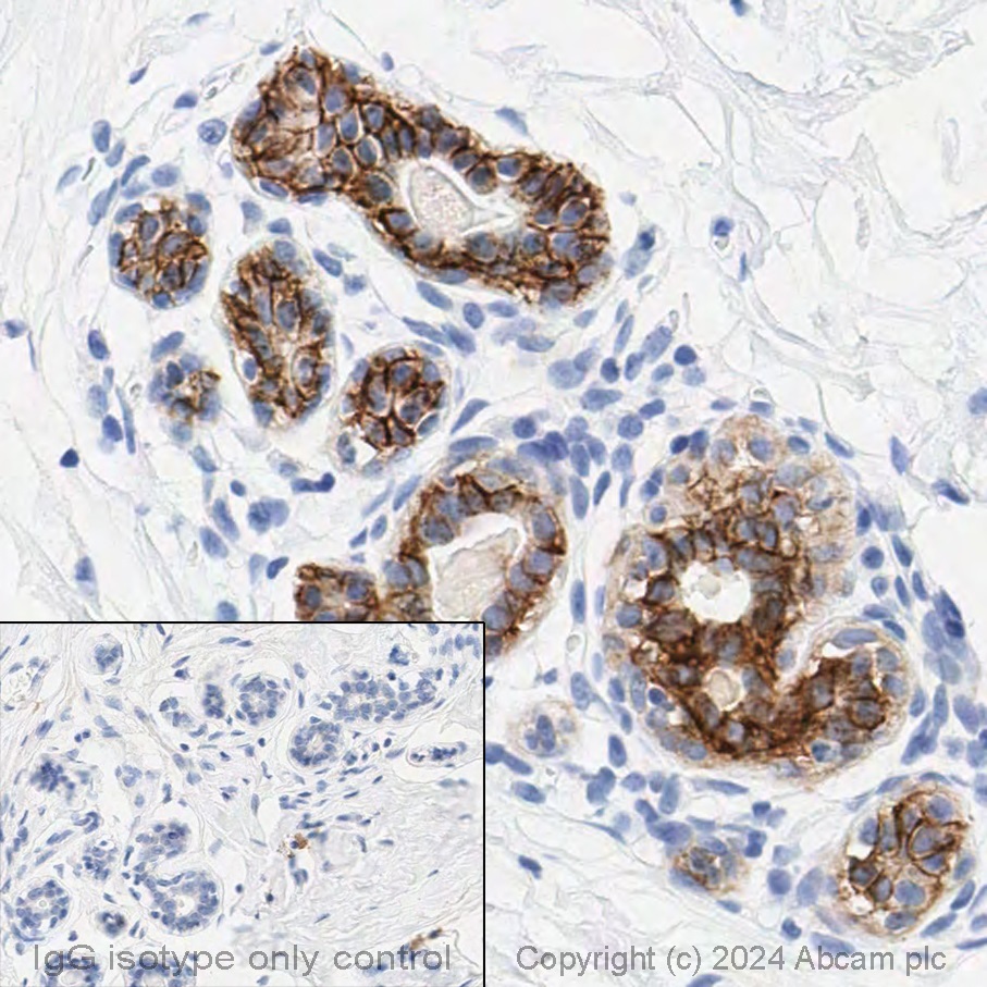 Immunohistochemistry (Formalin/PFA-fixed paraffin-embedded sections) - Anti-TROP2 antibody [EPR20043] (ab214488), expandable thumbnail