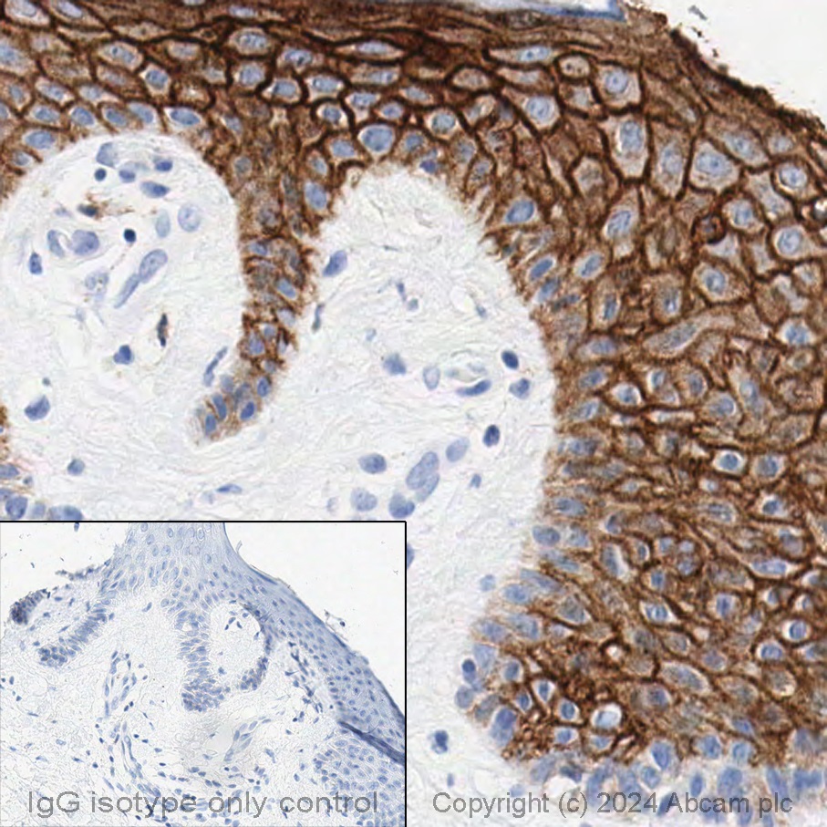 Immunohistochemistry (Formalin/PFA-fixed paraffin-embedded sections) - Anti-TROP2 antibody [EPR20043] (ab214488), expandable thumbnail