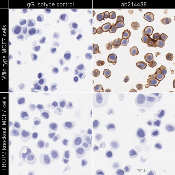 Immunohistochemistry (Formalin/PFA-fixed paraffin-embedded sections) - Anti-TROP2 antibody [EPR20043] (ab214488), expandable thumbnail