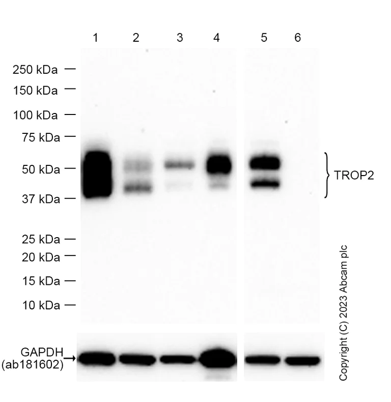 ピークハンド+α カリブ② Anti-TROP2 antibody [EPR20043] KO tested (ab214488) | Abcam
