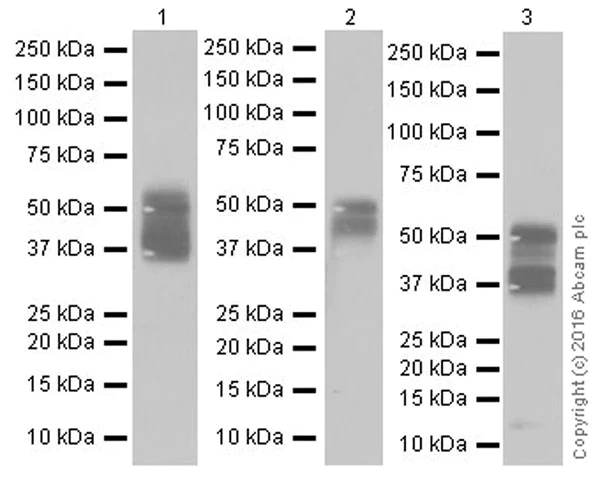 Anti-TROP2 antibody [EPR20043] KO tested (ab214488) | Abcam