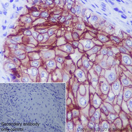 Anti-TROP2 antibody [EPR20043] - BSA and Azide free