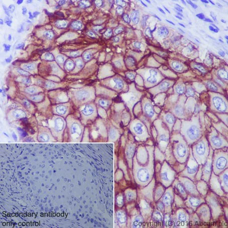 Immunohistochemistry (Formalin/PFA-fixed paraffin-embedded sections) - Anti-TROP2 antibody [EPR20043] - Low endotoxin, Azide free (AB222935)