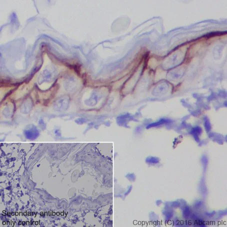 Immunohistochemistry (Formalin/PFA-fixed paraffin-embedded sections) - Anti-TROP2 antibody [EPR20043] - Low endotoxin, Azide free (AB222935)