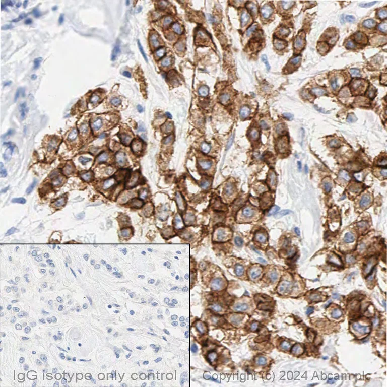 Immunohistochemistry (Formalin/PFA-fixed paraffin-embedded sections) - Anti-TROP2 antibody [EPR20043] - Low endotoxin, Azide free (AB222935)