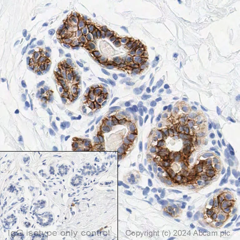 Immunohistochemistry (Formalin/PFA-fixed paraffin-embedded sections) - Anti-TROP2 antibody [EPR20043] - Low endotoxin, Azide free (AB222935)