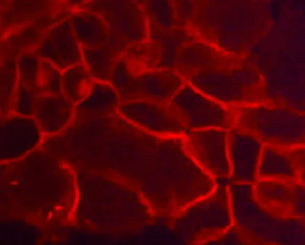 Immunocytochemistry/ Immunofluorescence - Anti-TROP2 antibody [M005] - Extracellular domain (AB253293)