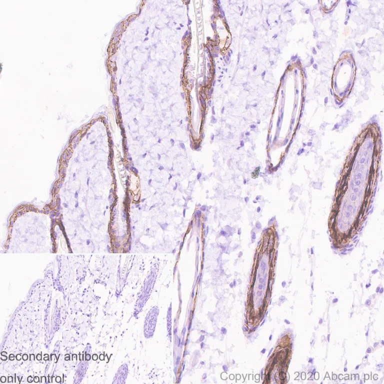 Immunohistochemistry (Formalin/PFA-fixed paraffin-embedded sections) - Anti-TROP2 antibody [SP293] - BSA and Azide free (AB272014)