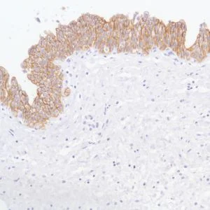 Immunohistochemistry (Formalin/PFA-fixed paraffin-embedded sections) - Anti-TROP2 antibody [SP293] - BSA and Azide free (AB272014)